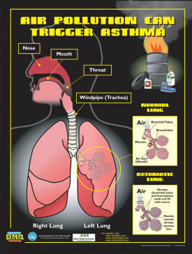 Air Pollution Can Trigger Asthma Poster